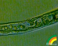 Bursaphelenchus xylophilus >> Bursaphelenchus xylophilus - Hembra detalle órganos reproductores.jpg